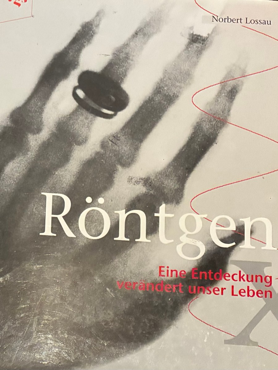 Von einer durchleuchteten Hand zum Schnittbild: Wie die CT&nbsp;entstand