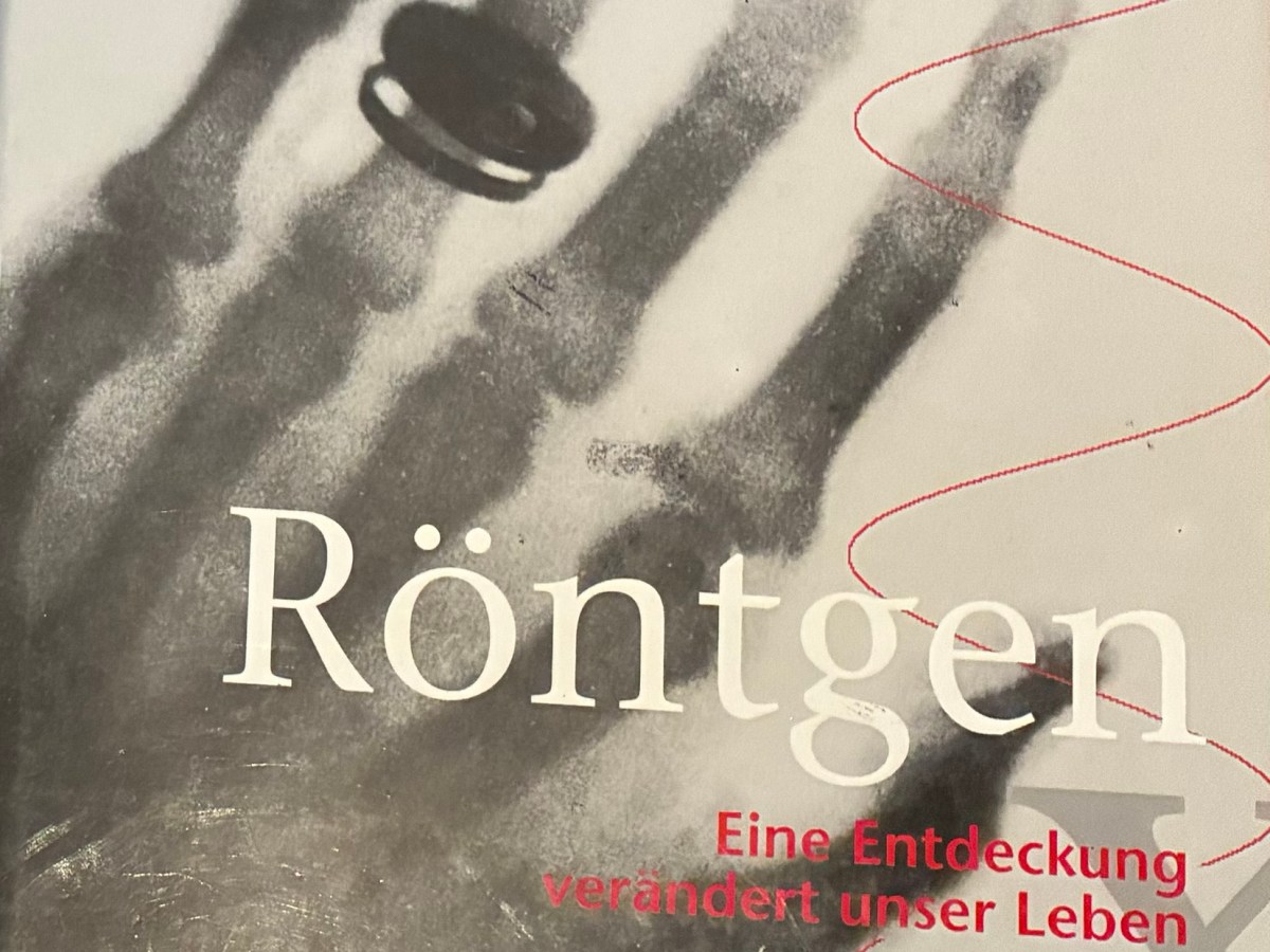 Von einer durchleuchteten Hand zum Schnittbild: Wie die CT&nbsp;entstand