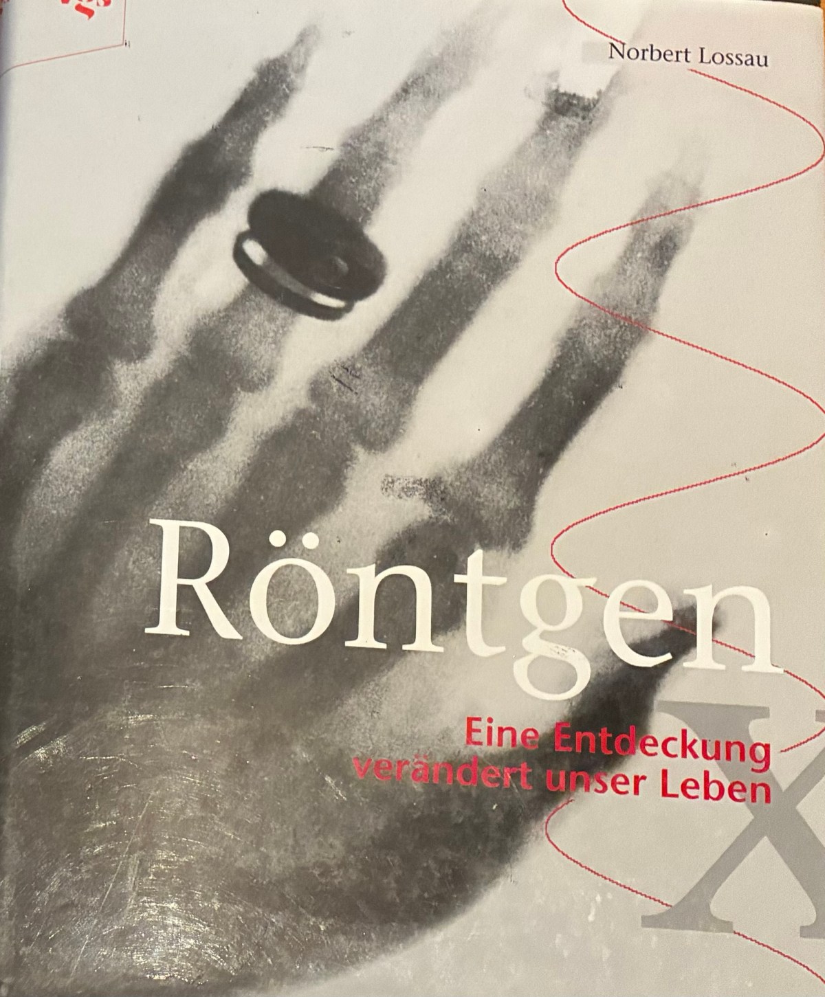 Von einer durchleuchteten Hand zum Schnittbild: Wie die CT&nbsp;entstand